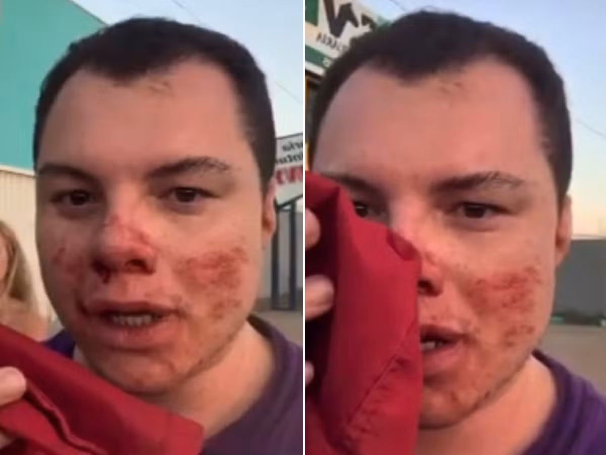 Influencer está em coma na UTI após ser agredido em festa universitária no interior de SP