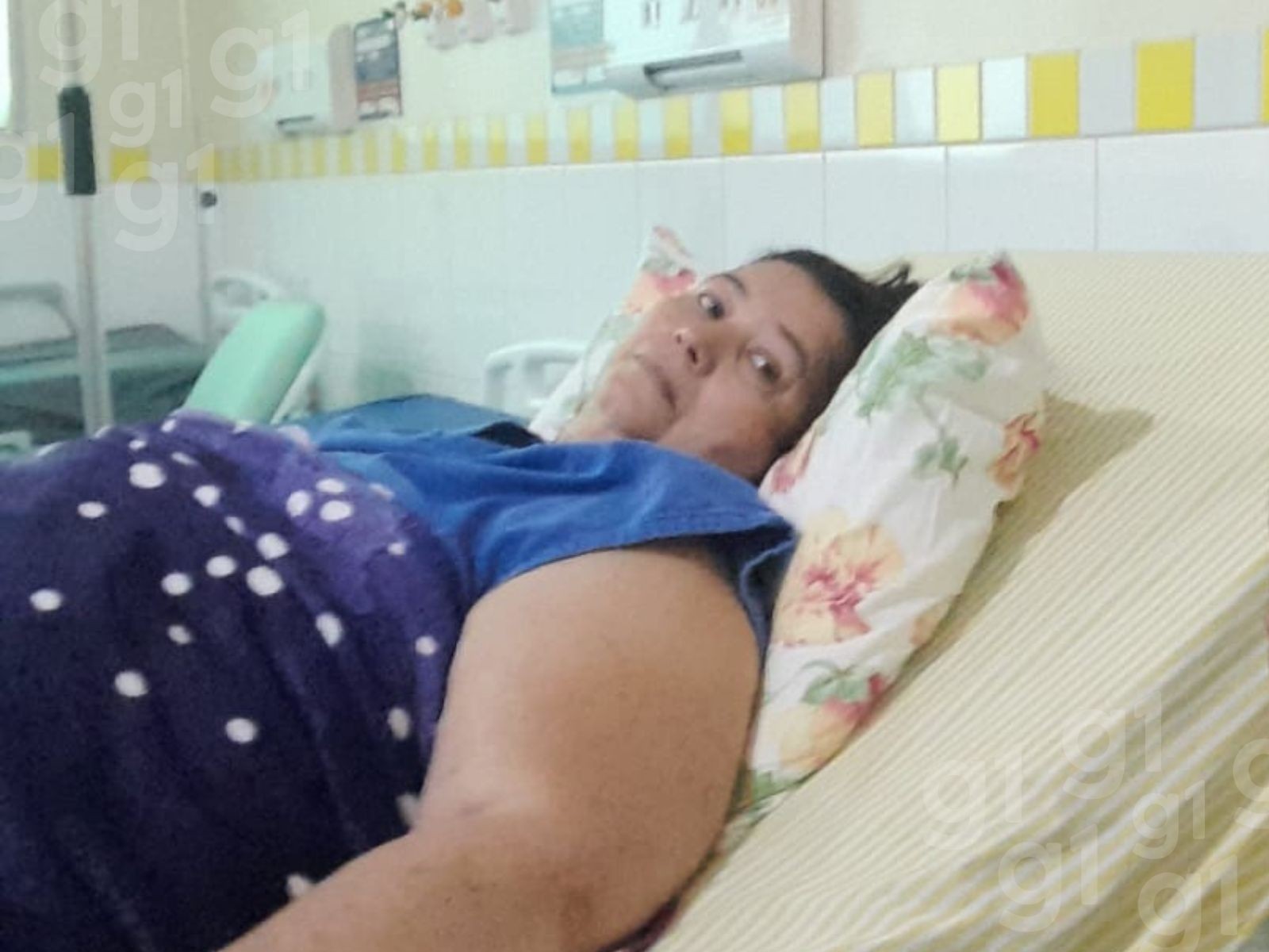 Cozinheira descobre doença rara na tireoide após sobreviver a acidente e passa por cirurgia no AC: 'Feliz de estar curada'