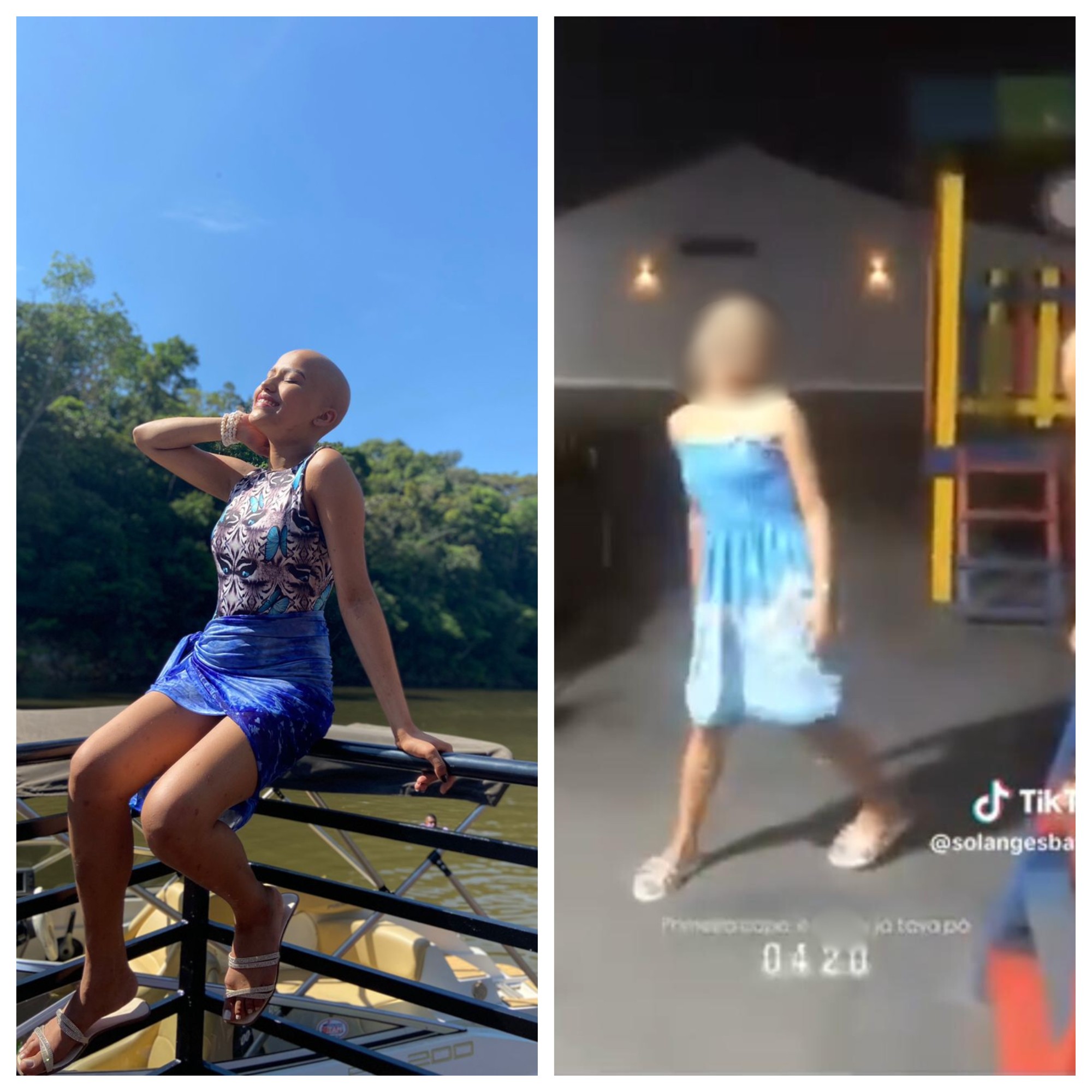 Adolescente com sequelas de câncer é alvo de bullying por colega de escola em RO; família leva caso à polícia