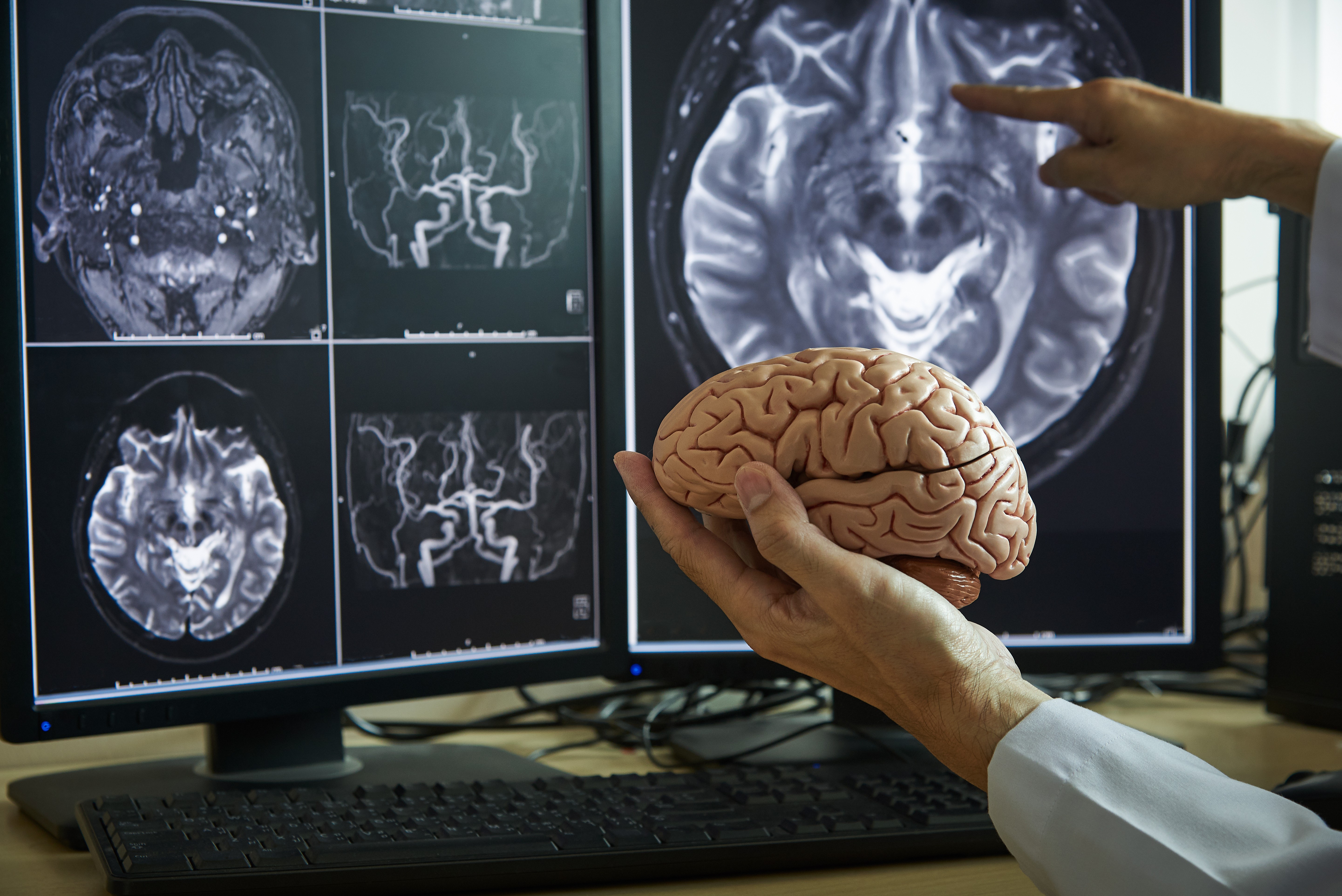 Neurônios não morrem: o enigma do envelhecimento cerebral pode mudar tratamento de Alzheimer e Parkinson