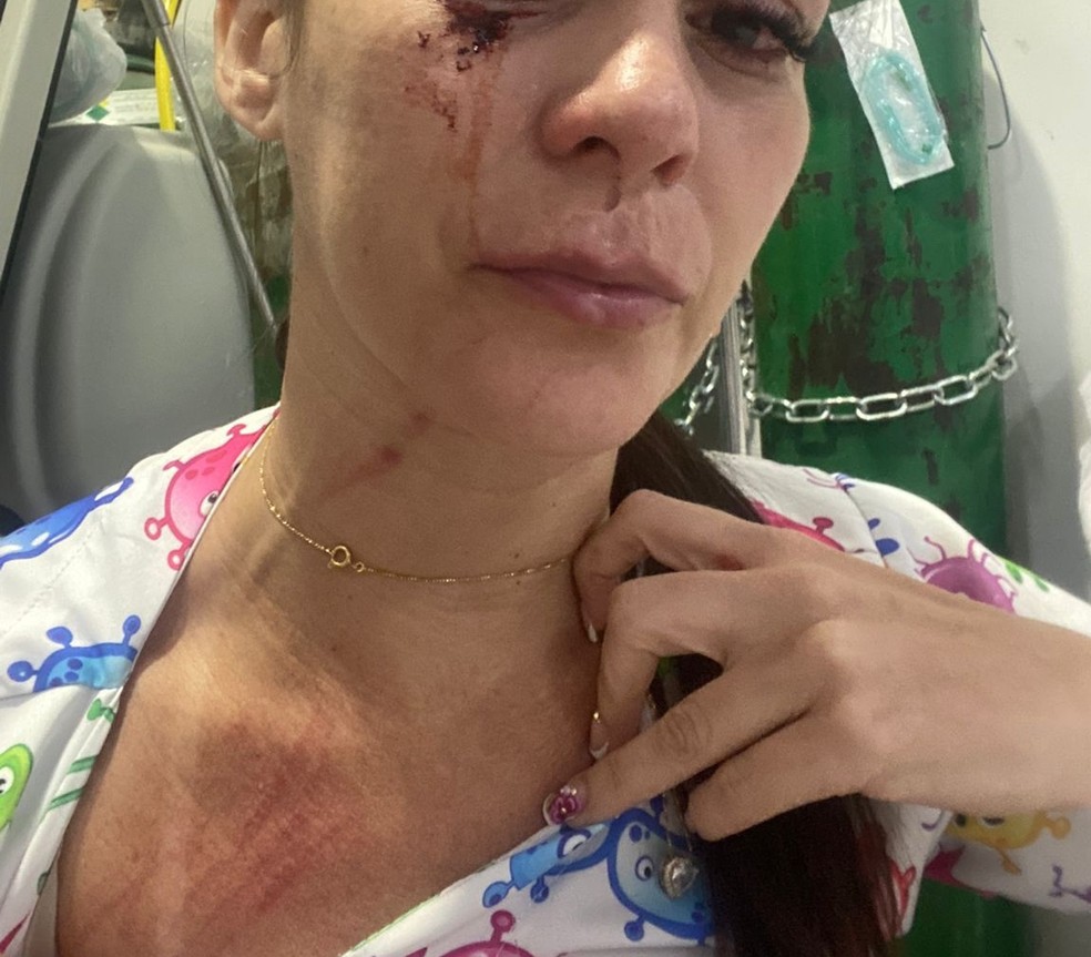 Enfermeira é agredida dentro do Hospital Municipal de Ariquemes, RO