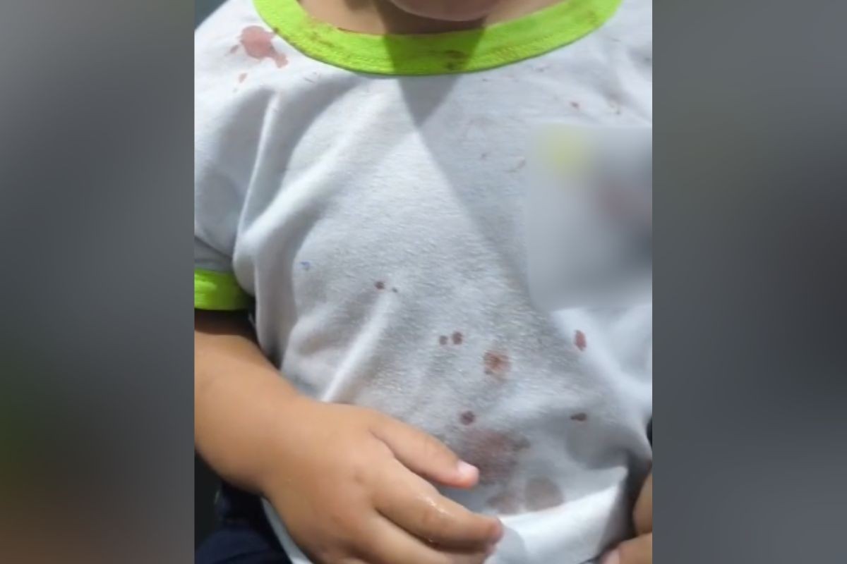 Funcionários de creche percebem hematomas e manchas de sangue em menina de 2 anos, acionam polícia e padrasto é preso no Paraná