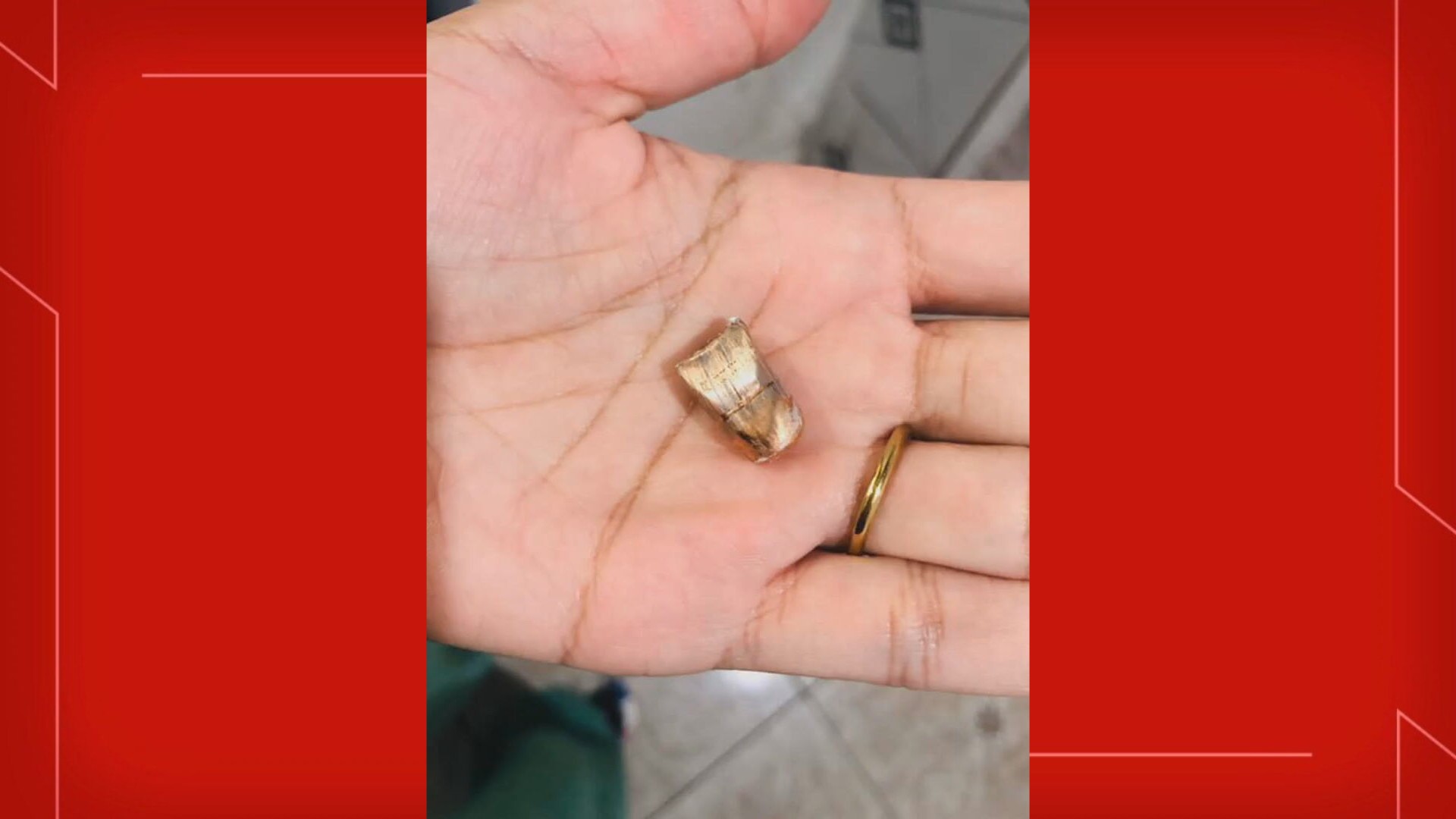 Homem é atingido de raspão por bala perdida dentro de casa no DF