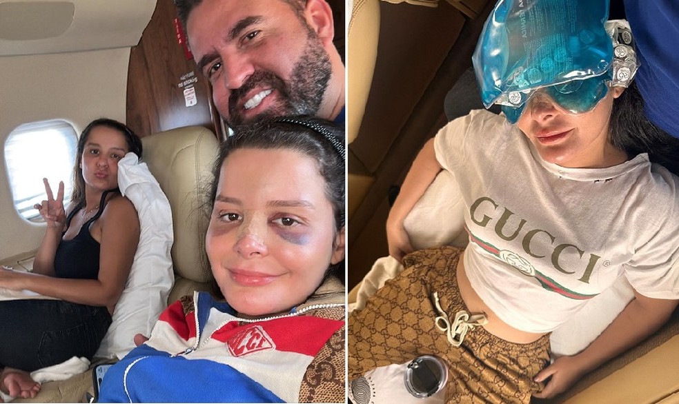 Maraísa posta foto e fala sobre acidente em piscina de resort em AL — Foto: Reprodução/Instagram