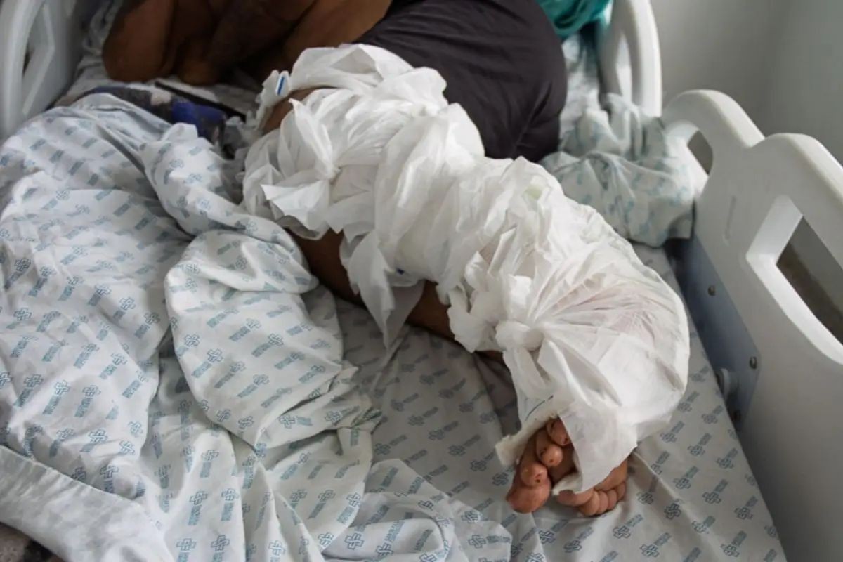 Diagnóstico por fotos e morte por infecção: Defensoria pede investigação na Santa Casa de Campo Grande