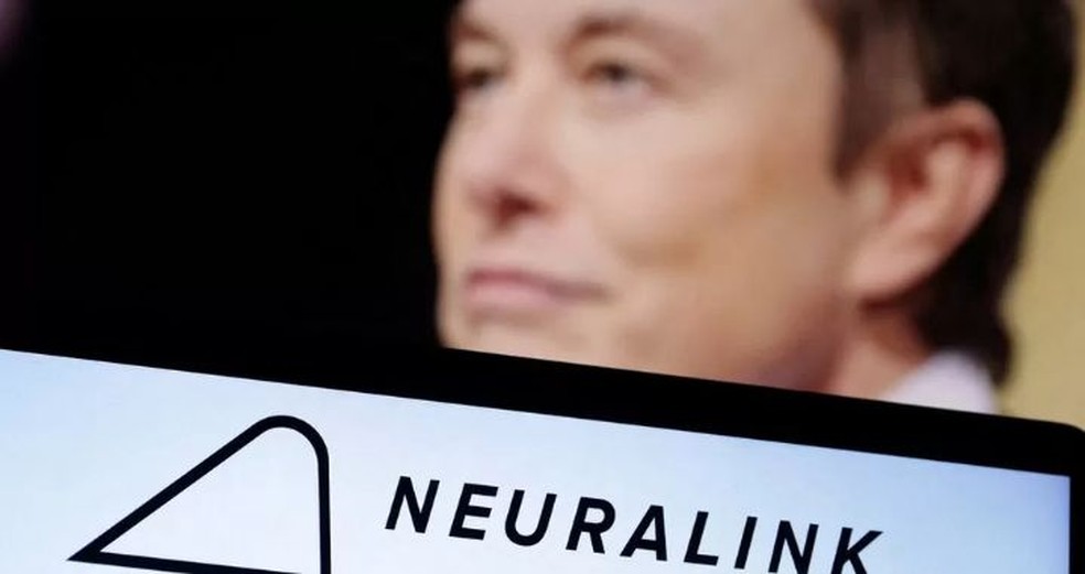 Neuralink faz o primeiro implante cerebral em humano — Foto: REUTERS