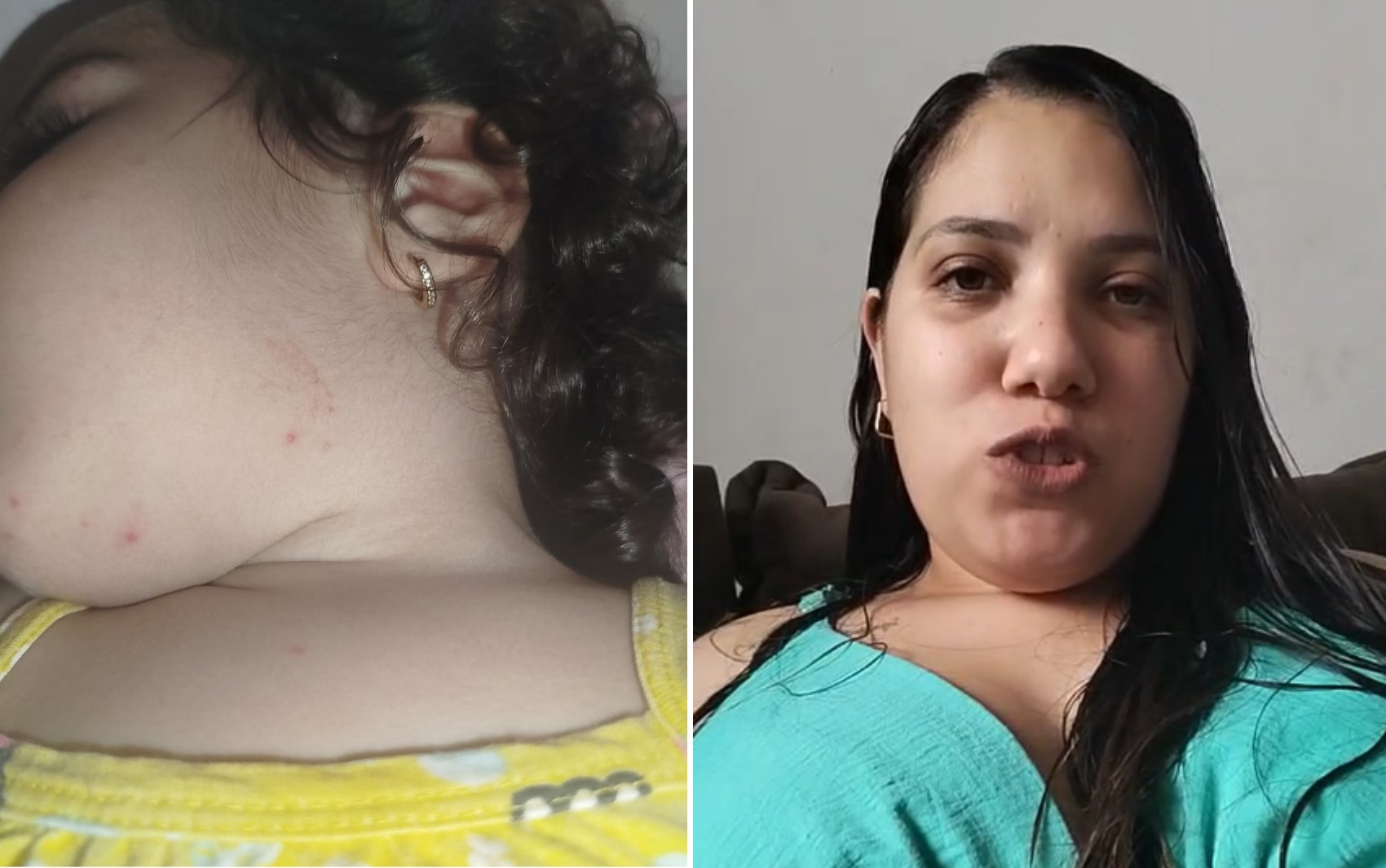 Mãe relata sintomas em toda a família após manchas vermelhas em bebê em Brodowski, SP: 'Pintinhas se espalharam'