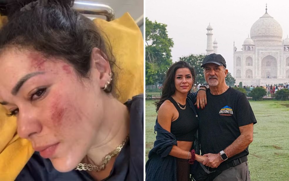 Fernanda Santos e o marido foram atacadas durante uma viagem à Índia — Foto: Reprodução/Redes Sociais