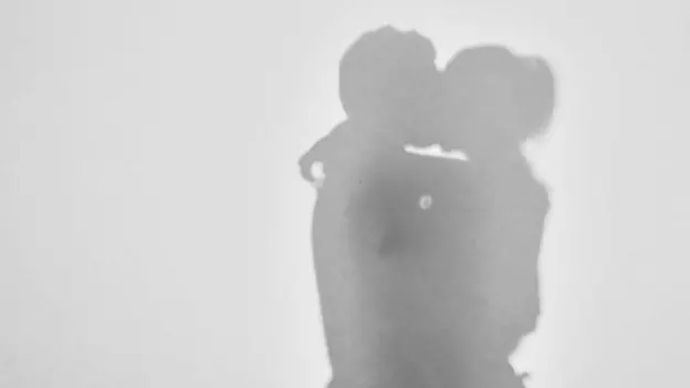 O beijo pode transmitir substâncias alergênicas pela saliva — Foto: GETTY IMAGES