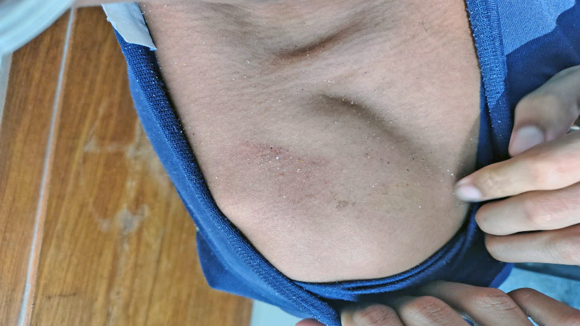 Mulher denuncia que filho foi espancado ao tentar salvar cachorro de maus-tratos