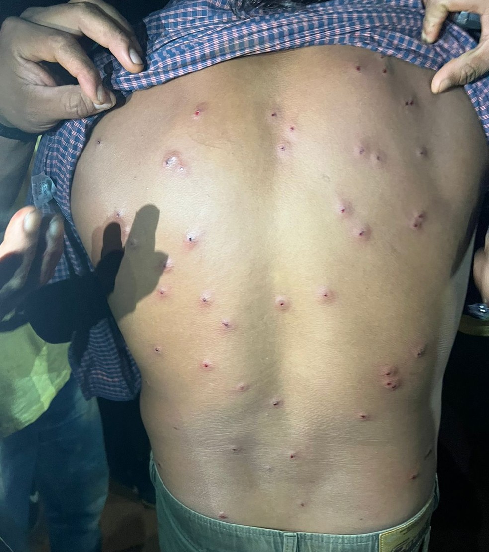 Pelo menos 20 indígenas ficaram feridos após tiros com balas de borracha — Foto: Divulgação