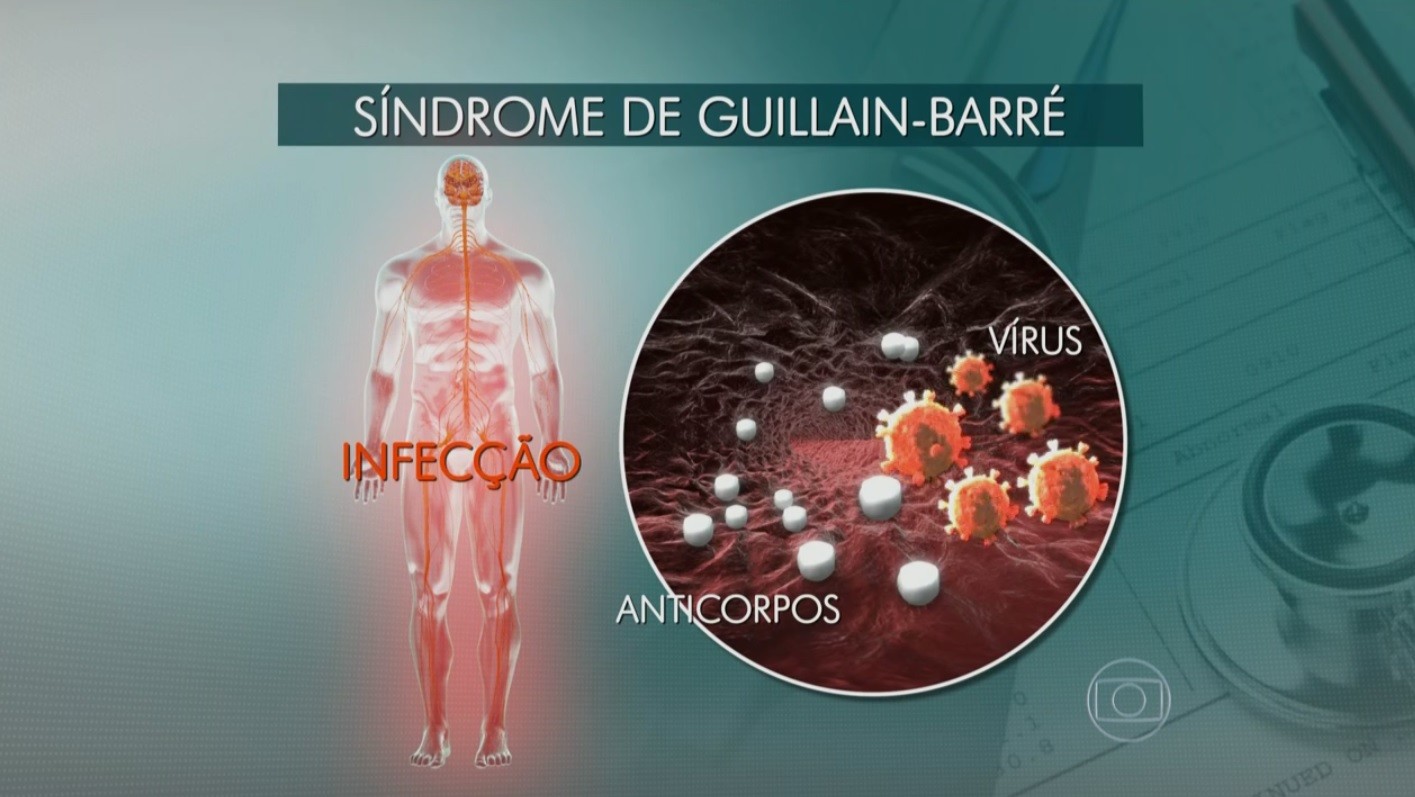 Síndrome de Guillain-Barré: entenda a doença
