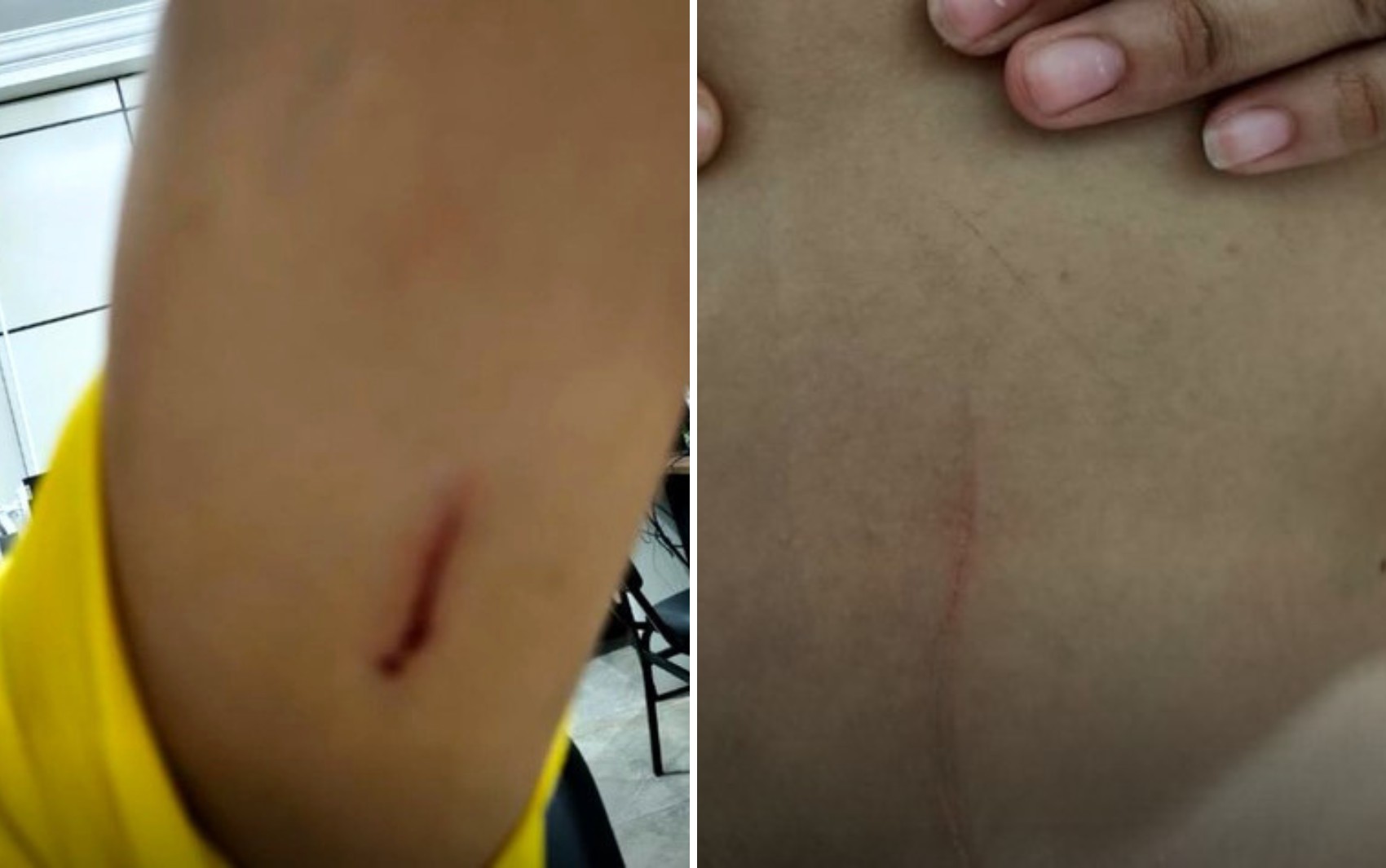 VÍDEO: Funcionária é agredida com tesoura por colega após tirar foto dela mexendo no celular para denunciar ao patrão, diz polícia  