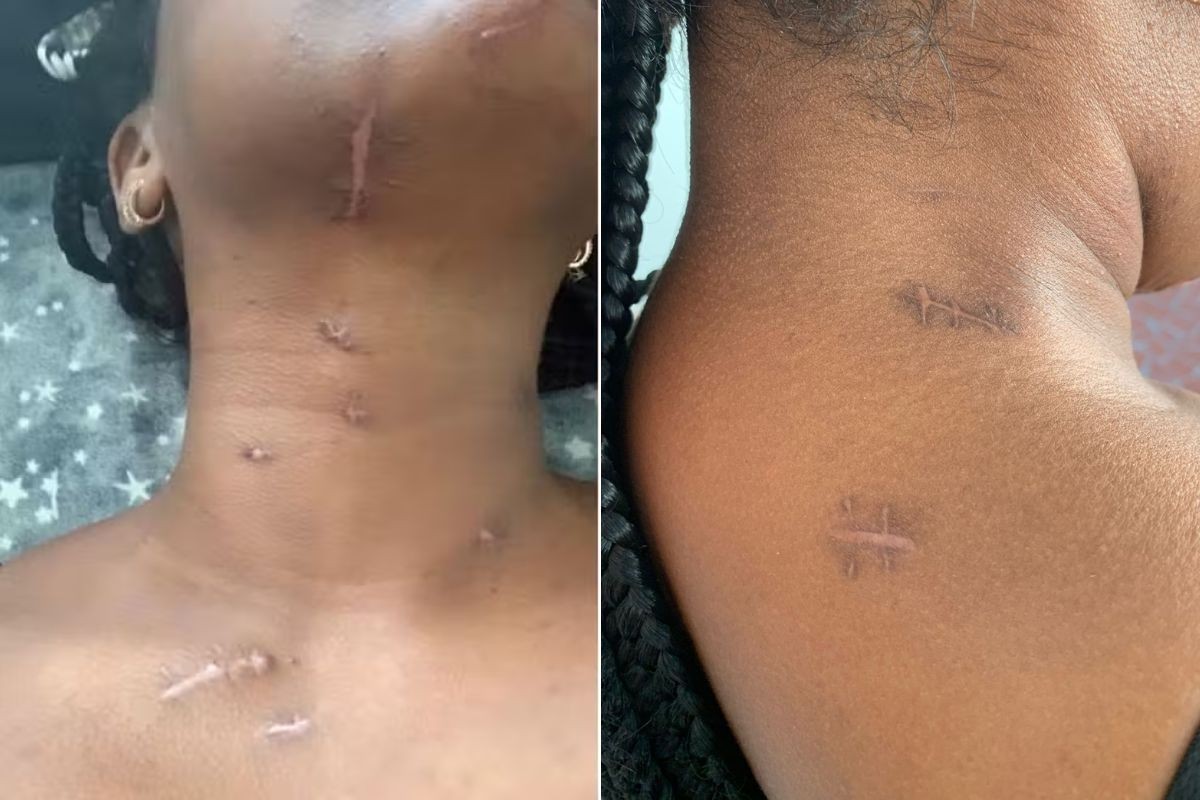 Mulher esfaqueada pelo ex enquanto filho dormia teve corda vocal atingida: 'Ele dizia que me amava', afirma