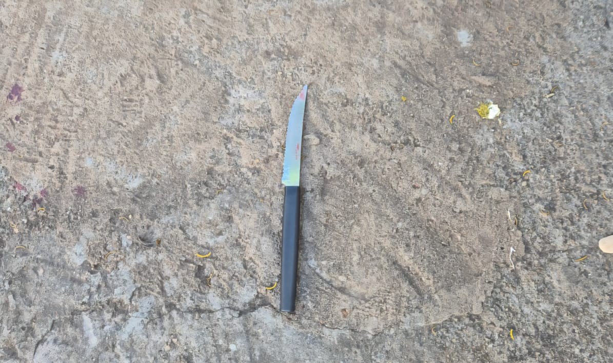 Jovem é ferida com faca de cozinha  pelo companheiro após briga por ciúmes em Limeira, diz Guarda 
