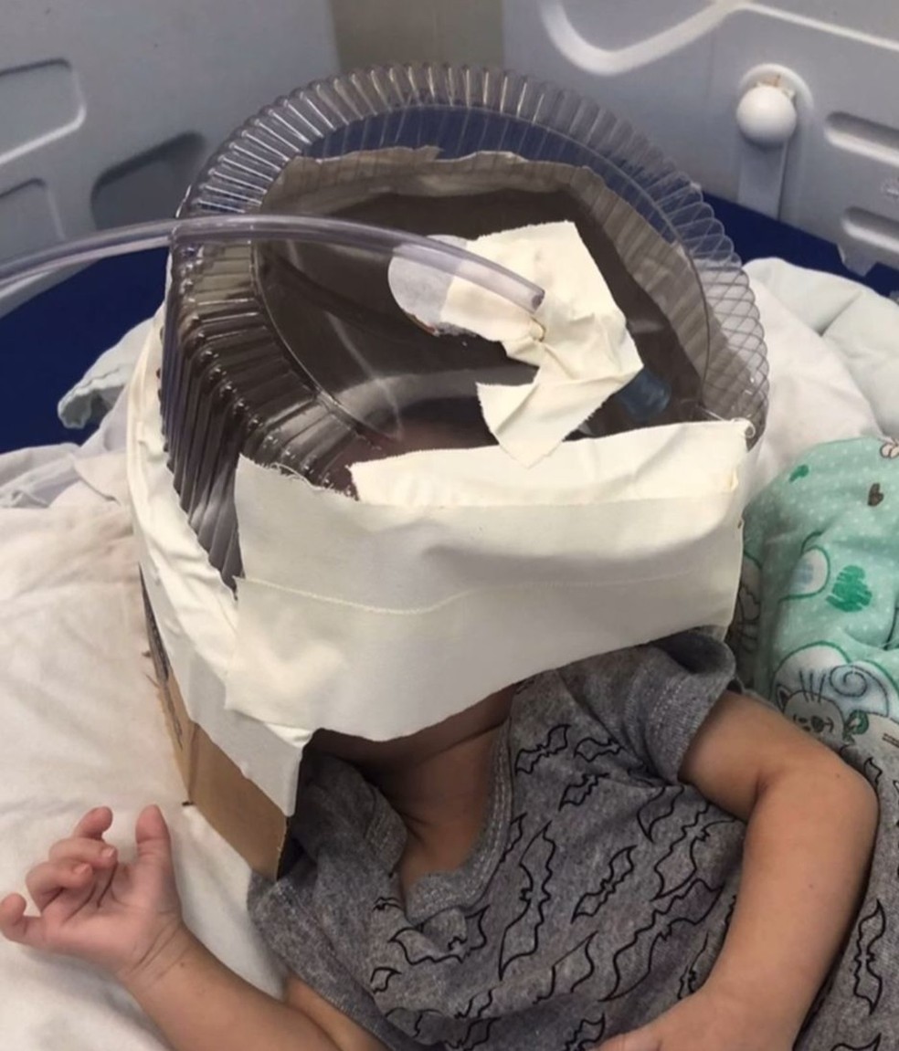Hospital usa embalagem de bolo como máscara de oxigênio em bebê de 3 meses — Foto: Reprodução