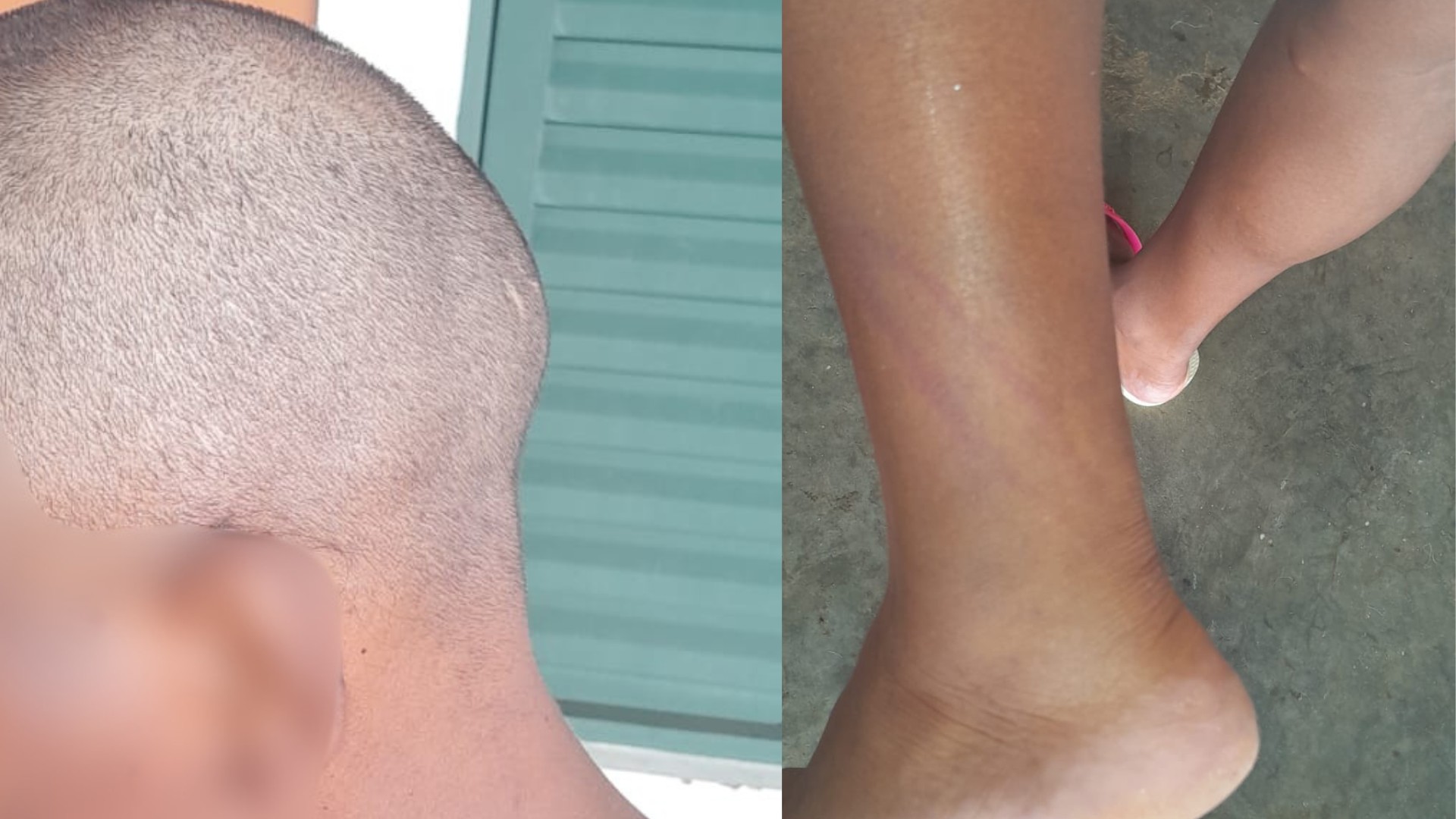 Mulher tem a cabeça raspada e é enforcada com corda pelo marido em MG