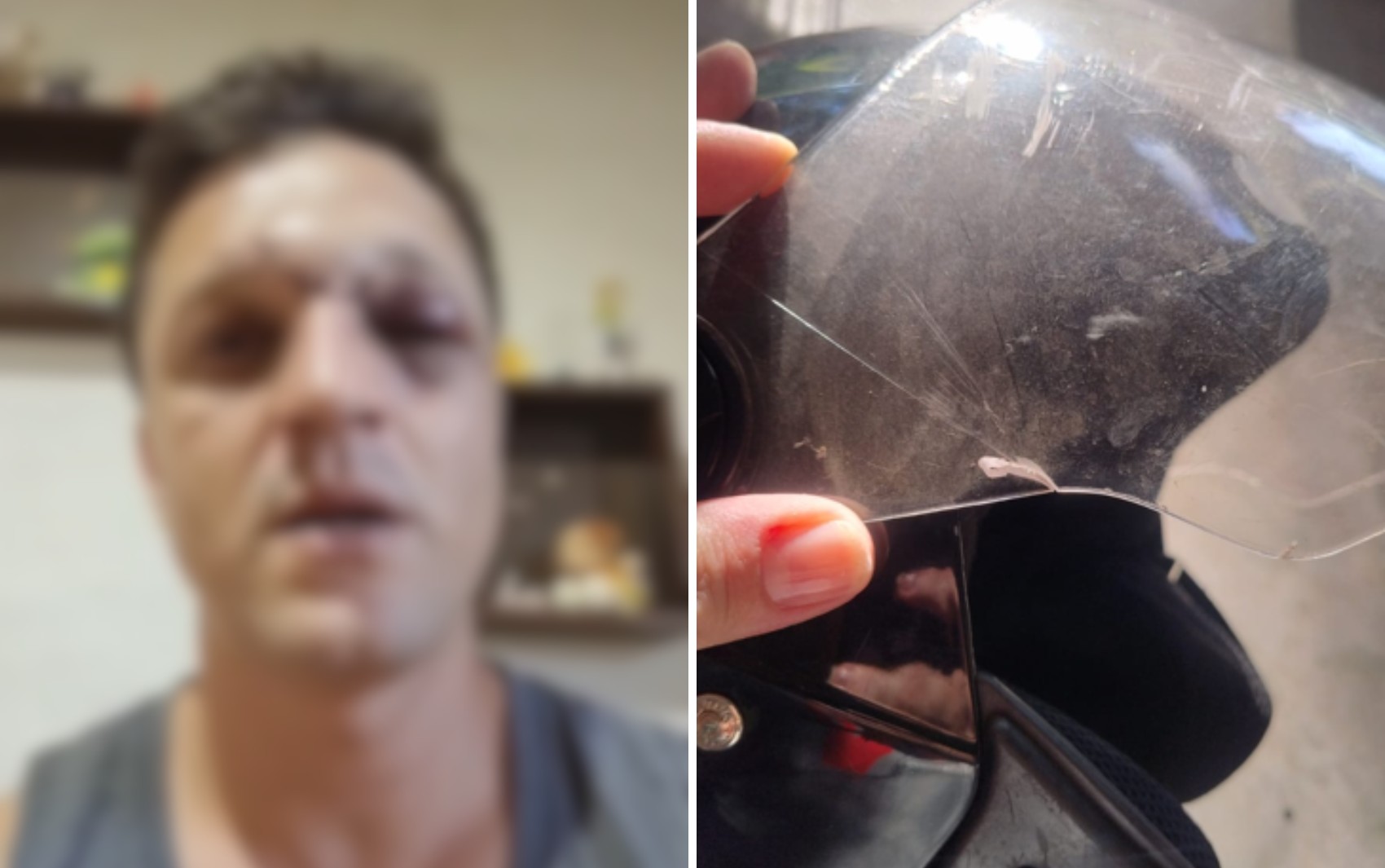 Motociclista tem o rosto cortado por linha de pipa com cerol em Barretos, SP