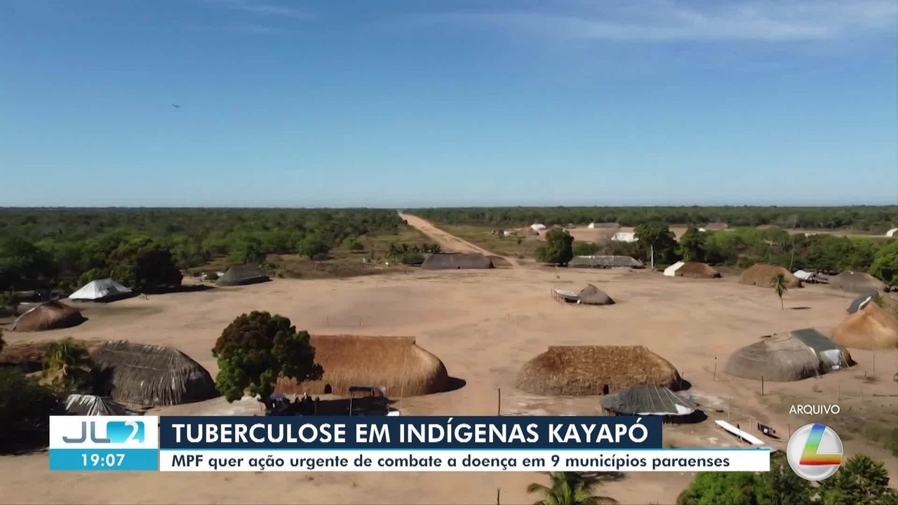 MPF pede ação urgente contra tuberculose entre indígenas Kayapó em nove municípios do Pará