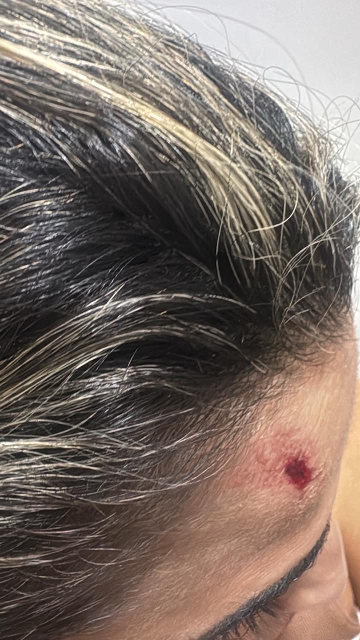 Homem invade casa e agride namorada durante comemoração, no Sertão da Paraíba