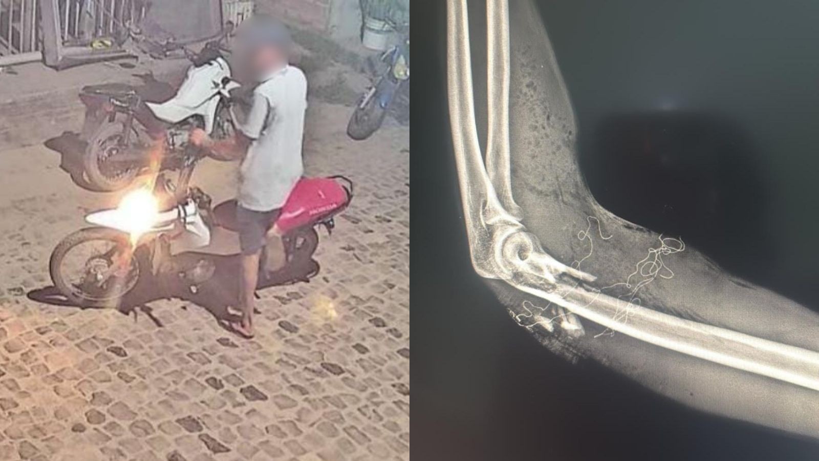 Jovem de 18 anos é baleado no braço enquanto entregava pizzas no PI