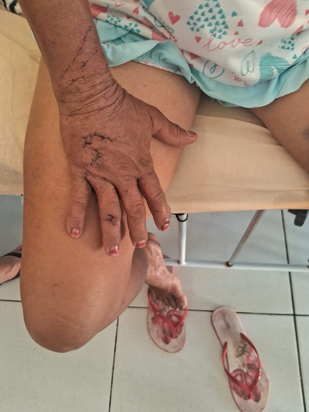 Mulher é ataca por onça no Sertão de Pernambuco. — Foto: Arquivo pessoal