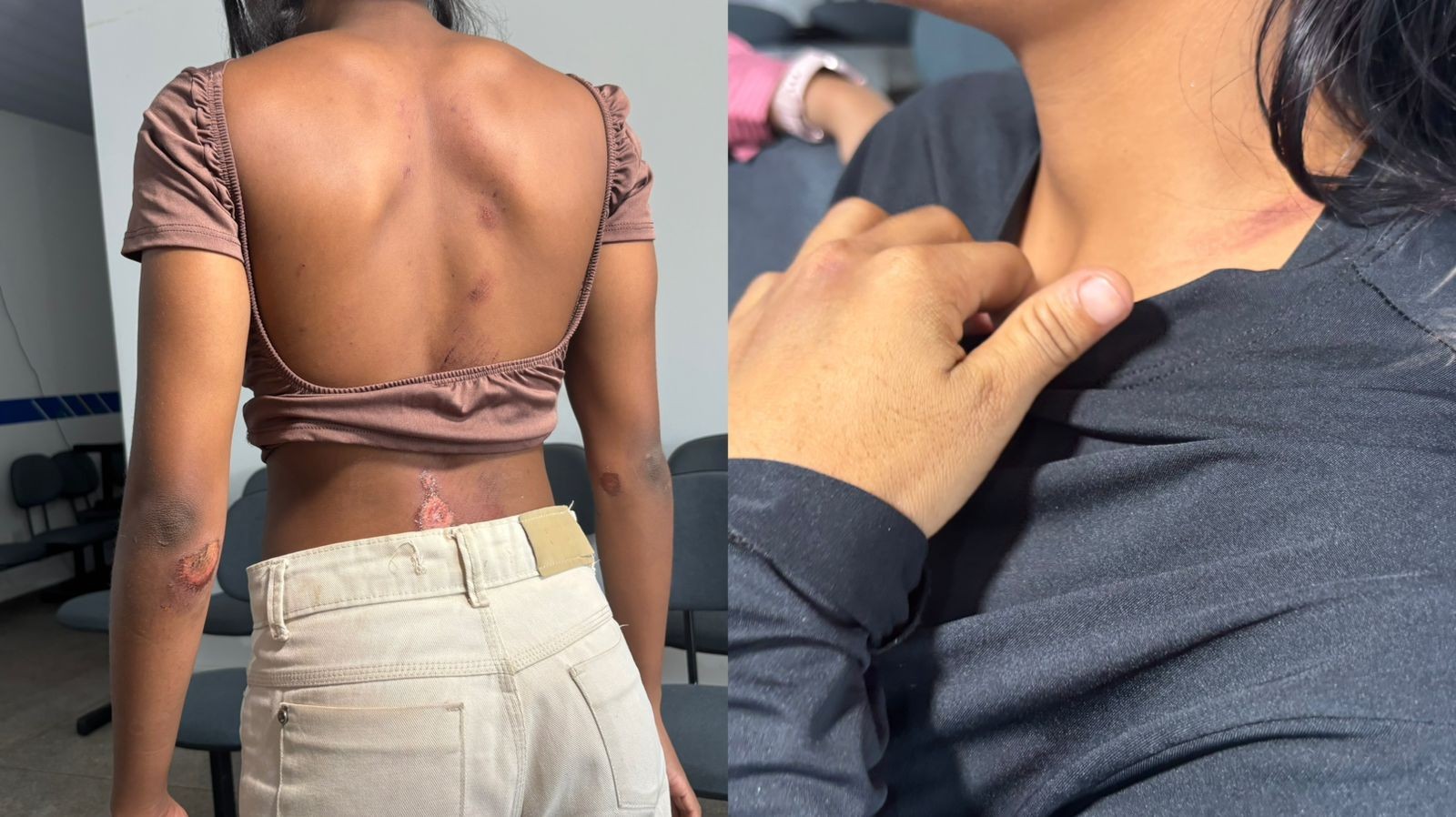 Jovens atropeladas no Amapá acusam motorista de racismo: ‘Pensei que ia morrer’