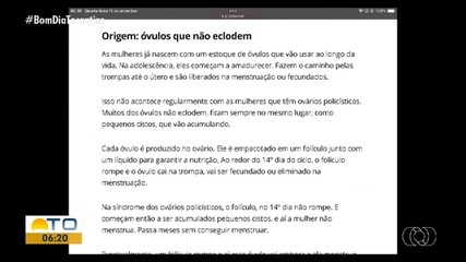 Bom Dia Responde fala sobre a síndrome dos ovários policísticos