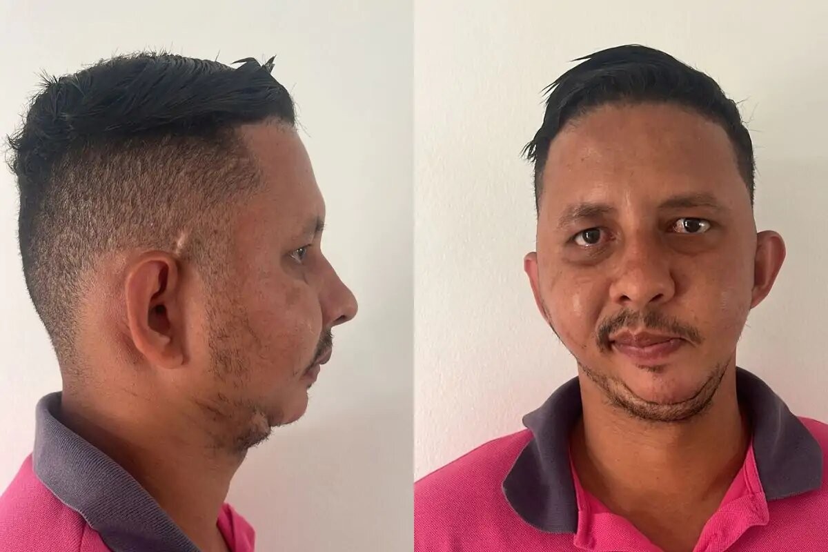 Morador de MT alvo de piada de Carlinhos Maia espera há mais de 10 anos por cirurgia de R$ 471 mil