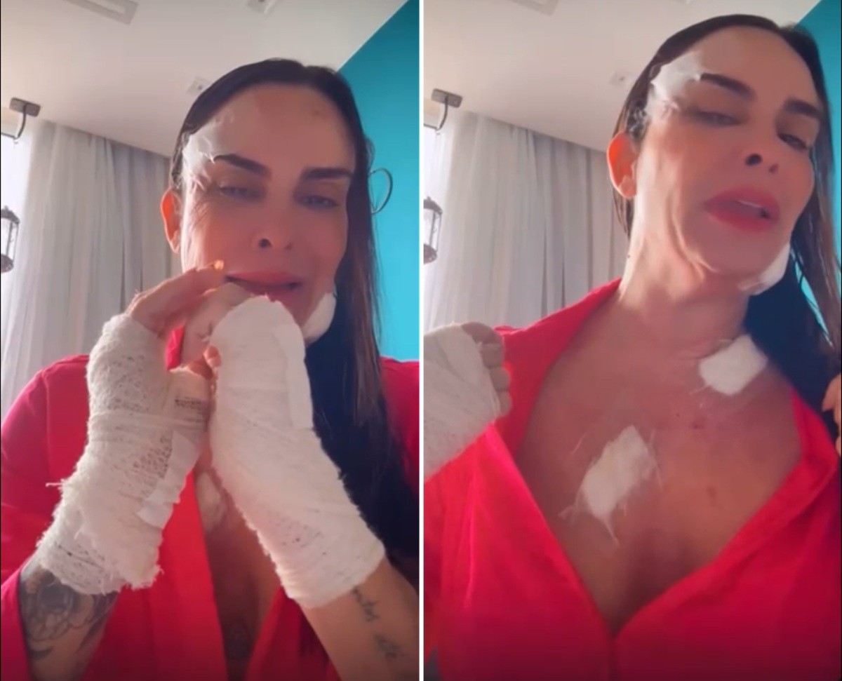 'Deus me deu força para que segurasse o objeto cortante que dilacerou as minhas mãos', diz empresária esfaqueada pelo ex em Cabo Frio