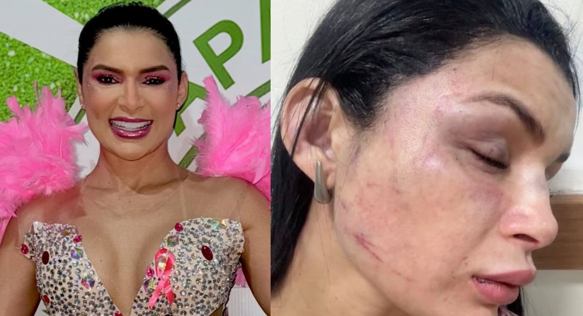 Musa de escola de samba denuncia agressão durante corrida de moto por app em Manaus