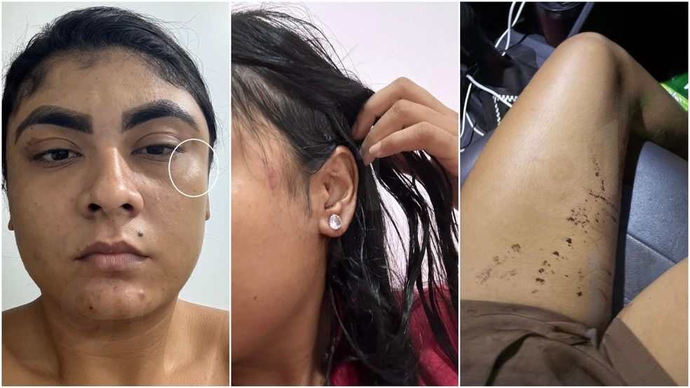 Policial Larissa Gomes da Silva, de 26 anos, que morreu após ser baleada pelo companheiro militar, havia relatado agressão anterior do homem para a amiga. — Foto: Arquivo pessoal