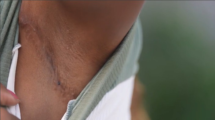 'Todas foram cobaias': clínica no Rio é investigada por mortes e mutilações em cirurgias plásticas