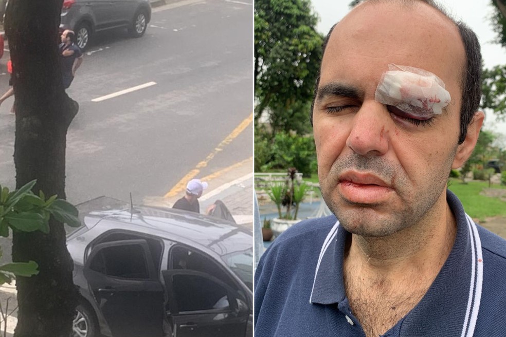 Advogado foi agredido por criminosos durante tentativa de assalto, no Itararé, em São Vicente (SP) — Foto: Reprodução