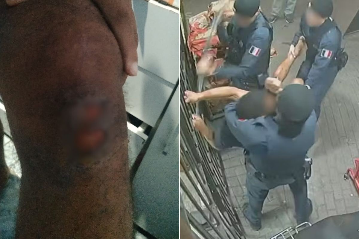 Homem agredido por guardas municipais nega acusação de furto: 'Achei que ia morrer'; VÍDEO