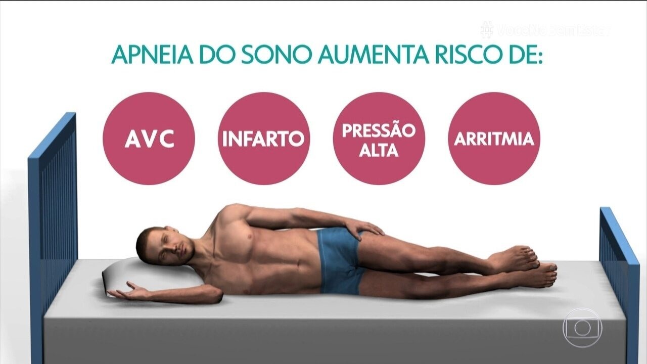 Apneia: ronco pode indicar falta de ar durante o sono | G1