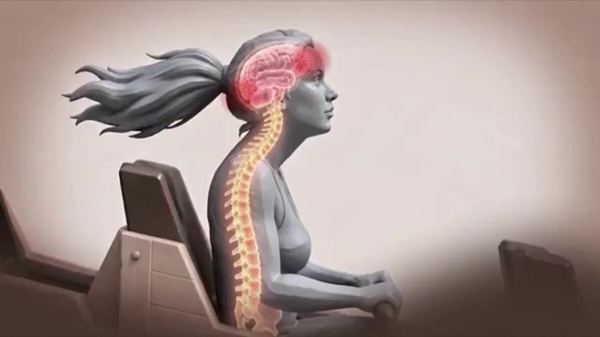 Traumatismo por 'contragolpe': entenda lesão cerebral sofrida por jovem após andar em montanha-russa
