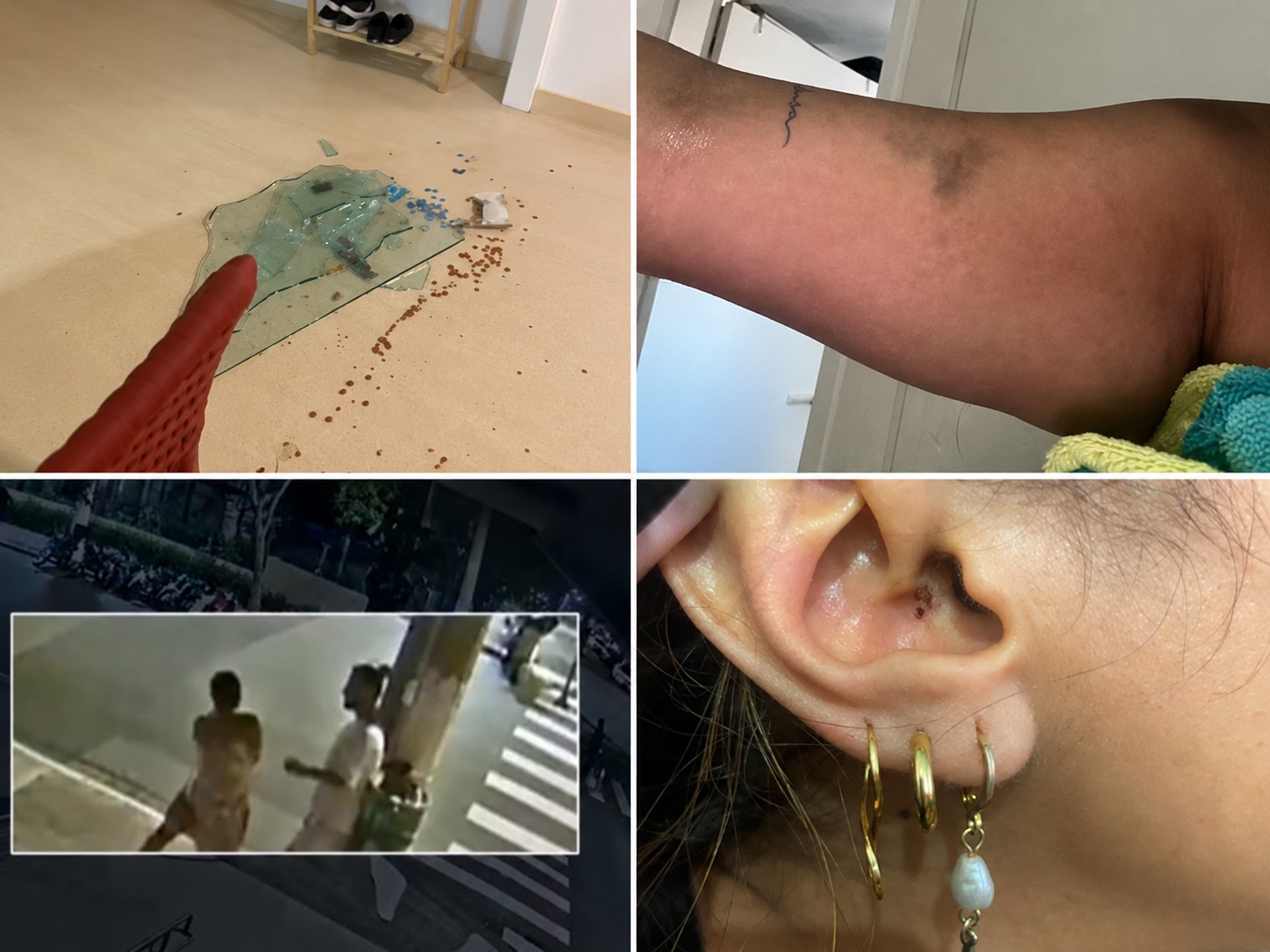 Orelha queimada, casa quebrada, hematomas e testemunhas: entenda denúncia contra Cartolouco por agressão