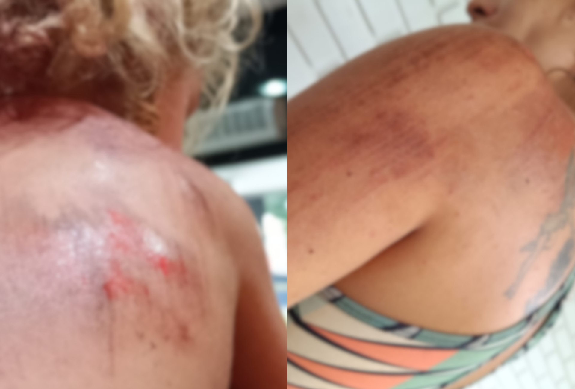 Mulher e criança ficam feridas após motorista de app arrancar com carro em Dourados