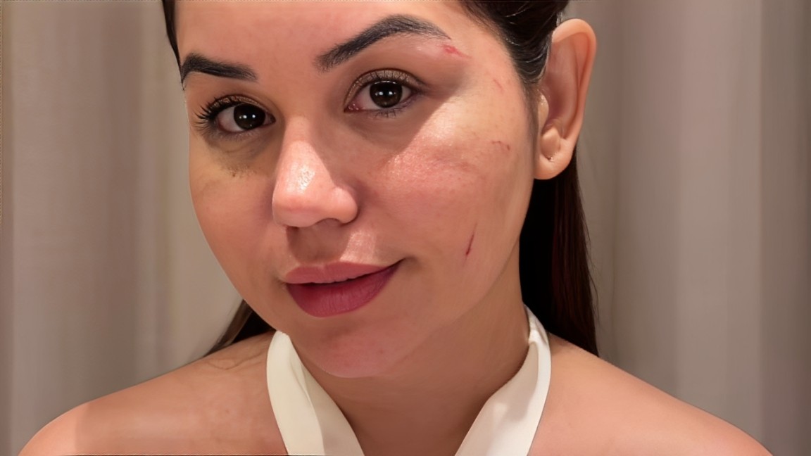 Esposa de sertanejo é agredida pela ex dele e diz temer pela própria vida e pela do marido; VÍDEO