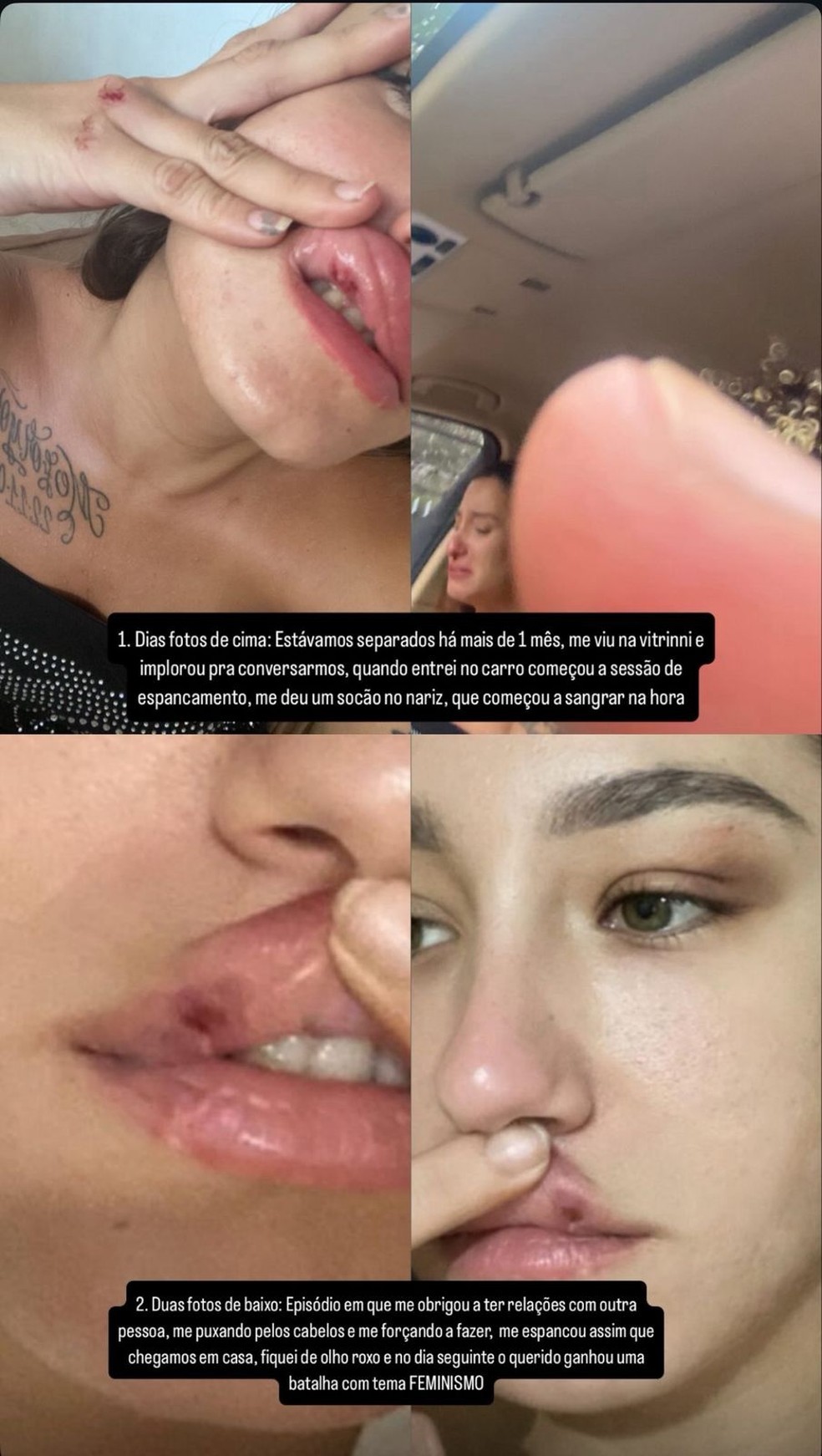 Ex de MC Estudante mostrou fotos de agressões em sua conta no Instagram — Foto: Reprodução