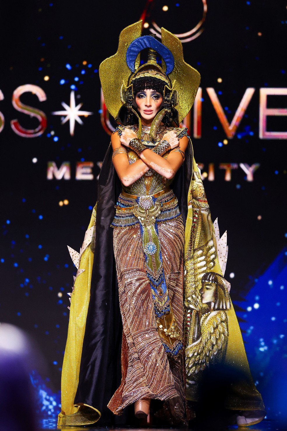 A modelo egípcia Logina Salah, candidata ao Miss Universo 2024 e primeira modelo com vitiligo a concorrer ao concurso — Foto: Raquel Cunha/Reuters