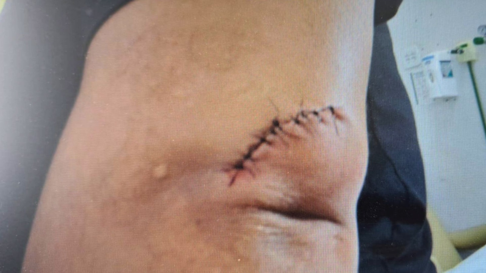 Motorista de aplicativo fere passageira com canivete após acusá-la de bater porta do carro em Uberaba