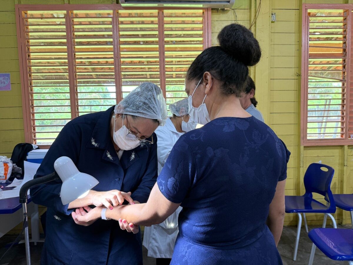 Seis casos de tuberculose latente são confirmados em comunidade rural de Macapá