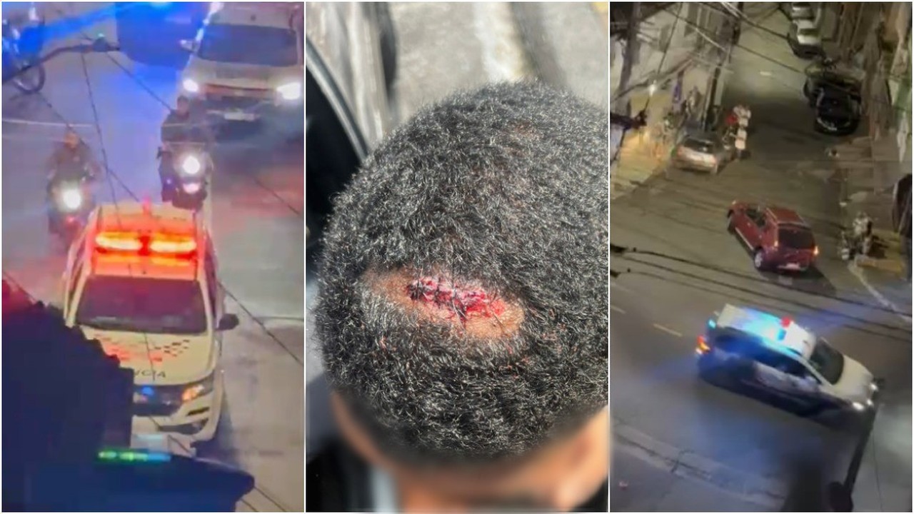 VÍDEO: jovem diz ter sido atingido na cabeça por tiro de PM; policiais aparecem 'cortando giro' em motos apreendidas