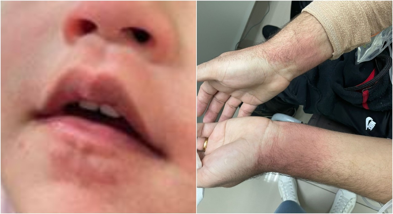 Justiça solta médica suspeita de atacar família com spray de pimenta durante missa em Jundiaí