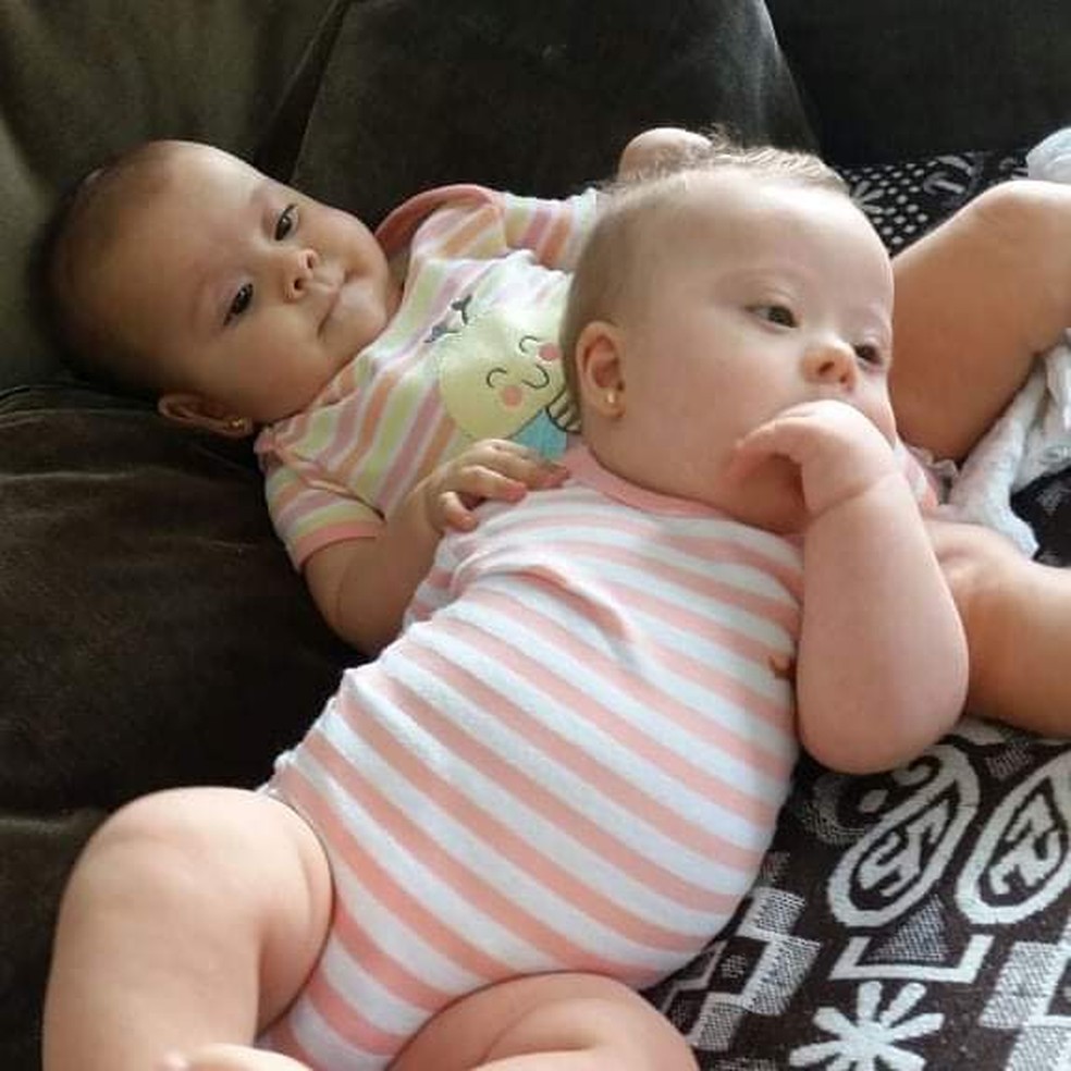 Descobri um mês depois do parto que minhas gêmeas têm síndrome de Down' -  BBC News Brasil