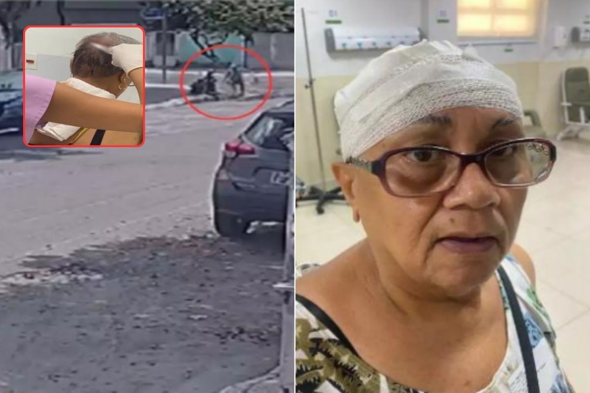 Justiça condena Prefeitura de Santos a pagar R$ 3 mil a idosa que caiu em buraco