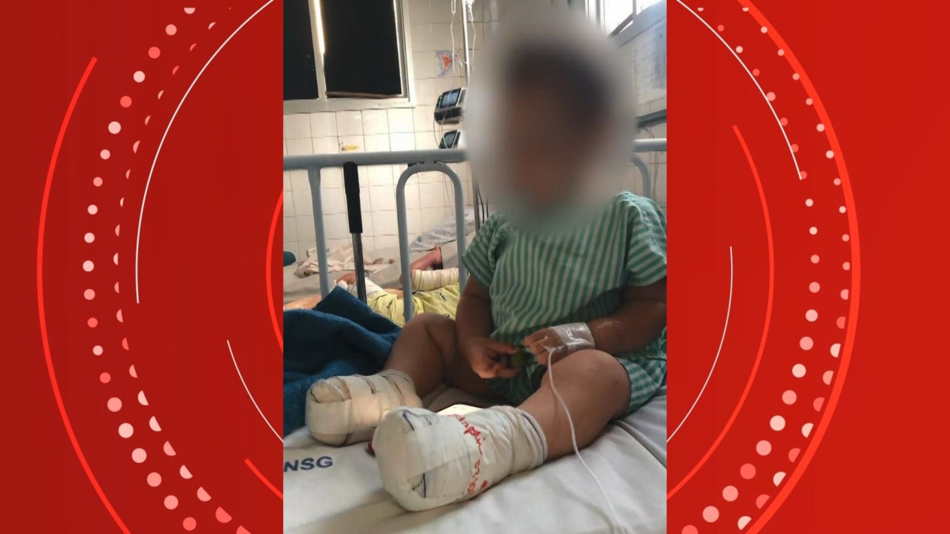 Bebê é internado após ter os pés queimados em creche particular no ES