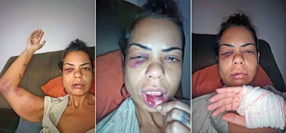 Diana Campos Lopes foi agredida em briga de trânsito — Foto: Reprodução/TV Globo